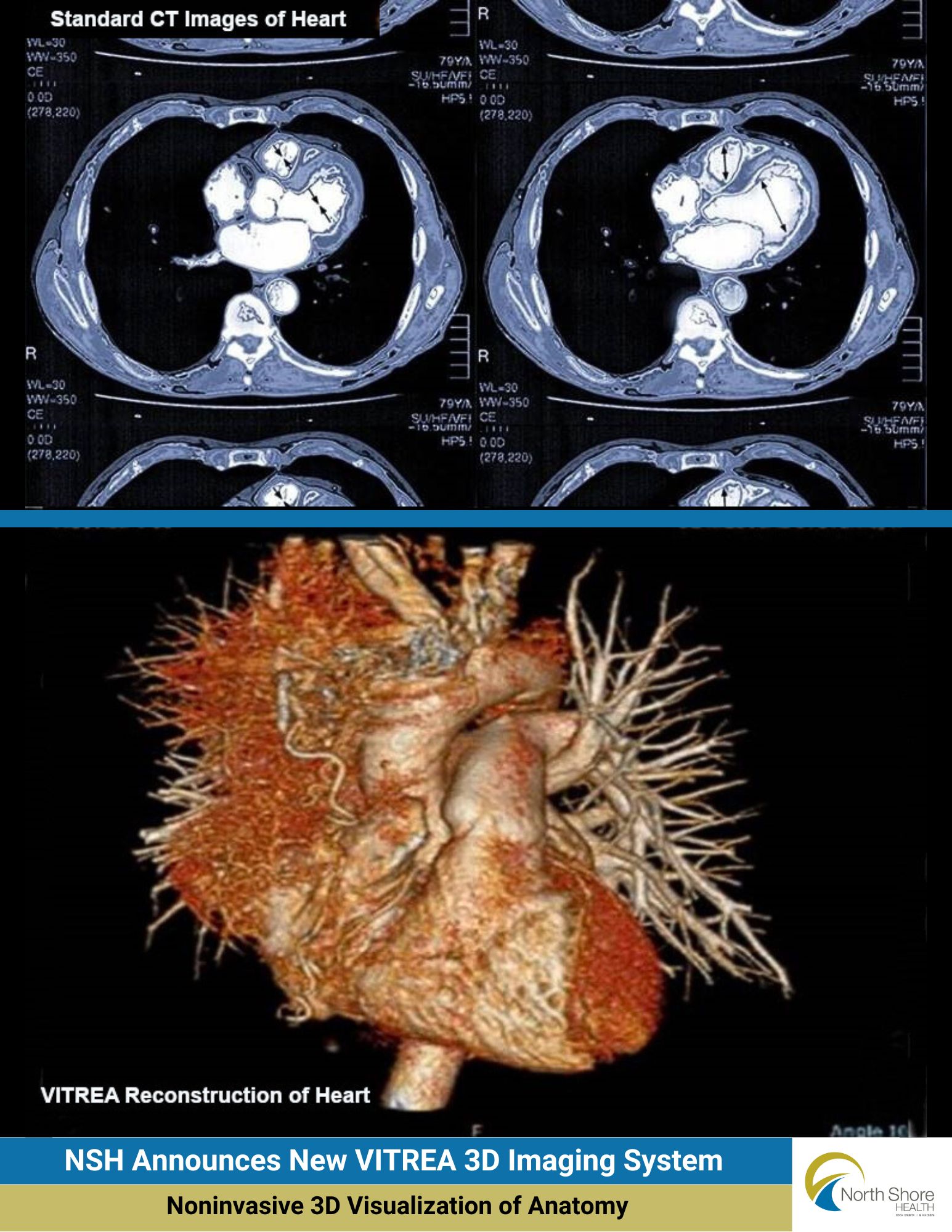 North Shore Health Announces New VITREA 3D Imaging System